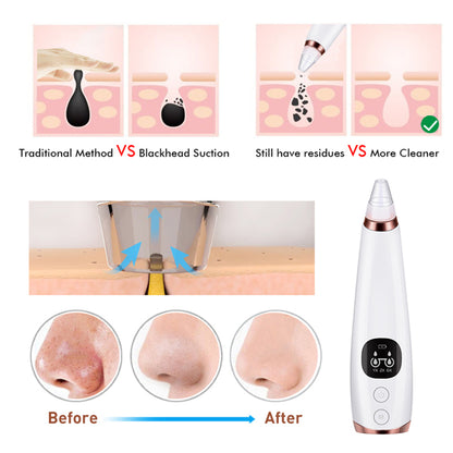 Microcrystalline Blackhead Beauty Instrument